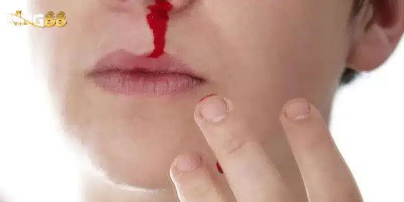 Giải mã chi tiết các trường hợp nằm mơ thấy máu đỏ